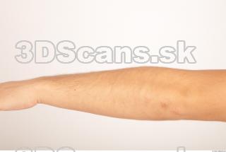 Photo reference of forearm 0001